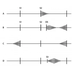 Article figure