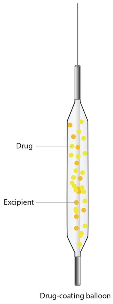 Drug-eluting balloons model.