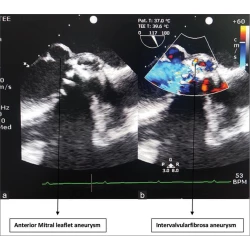 Article figure