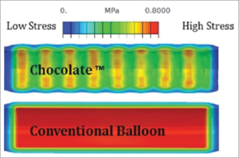 Pressure distribution along the vessel wall while using a chocolate balloon as compared to a conventional balloon. (courtesy Cordis corporation).