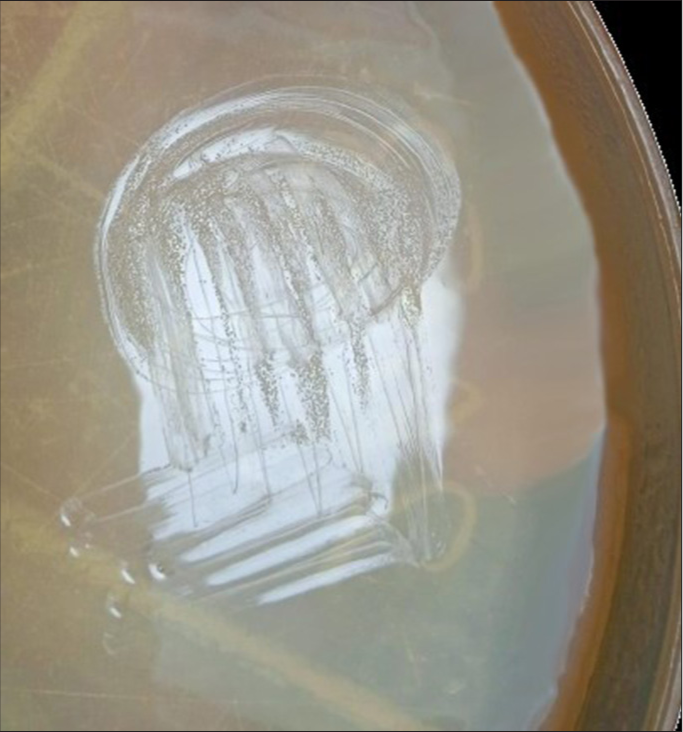 Culture plate showing Corynebacterium diphtheriae colony. Nutrient agar plate showing Corynebacterium diphtheria colonies