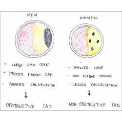 Article figure